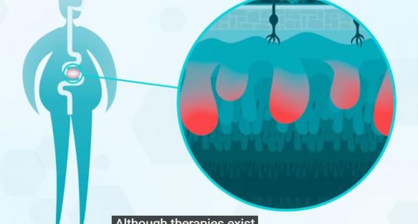 Algae4IBD